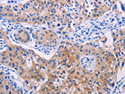 AGT Antibody