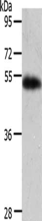 AGT Antibody