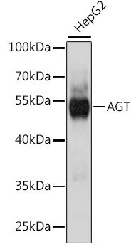 Angiotensin II antibody
