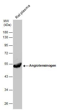 Angiotensin II antibody