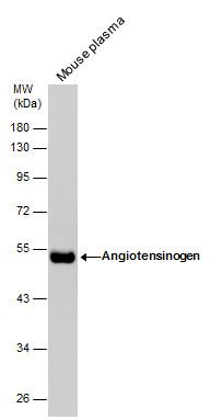 Angiotensin II antibody