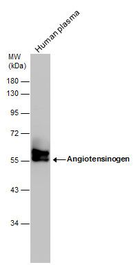 Angiotensin II antibody