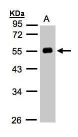 Angiotensin II antibody