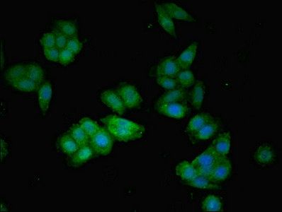 Angiotensinogen antibody