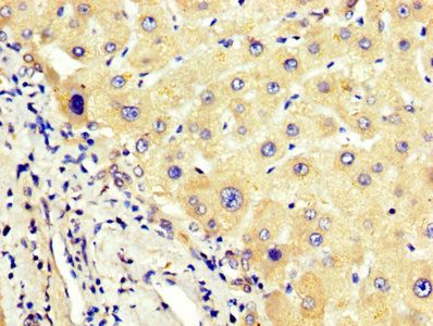 AGT Antibody