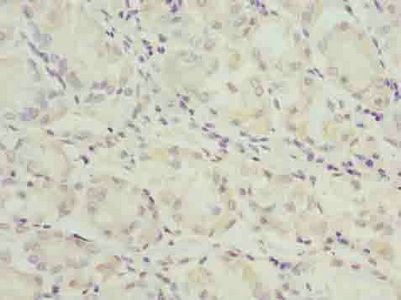 Angiotensinogen antibody