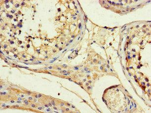 ANGPTL1 Antibody