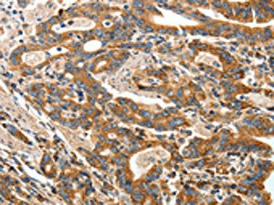 ANGPTL1 Antibody