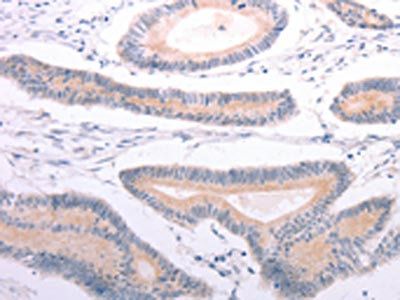 ANGPTL2 Antibody