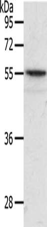 ANGPTL2 antibody