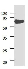 ANGPTL3 antibody