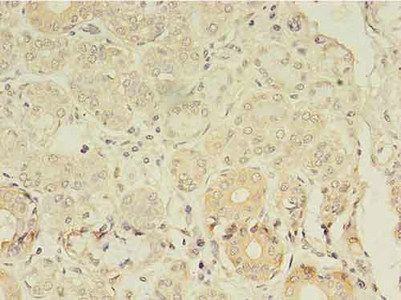 ANGPTL7 Antibody