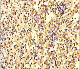 ANKDD1A Antibody