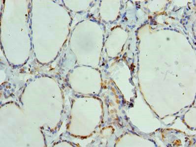 ANKMY1 Antibody