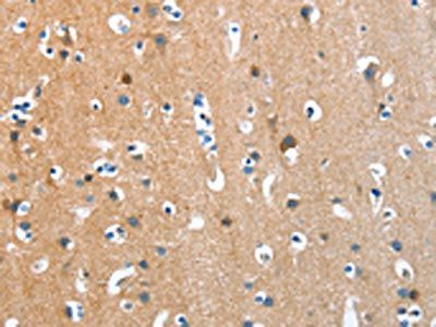 ANKMY1 Antibody