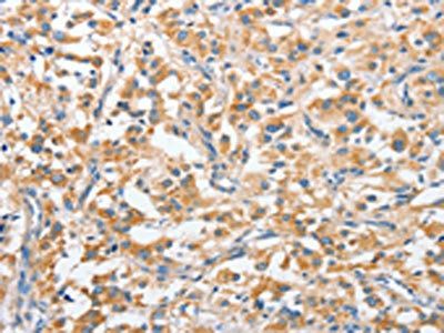 ANKMY2 Antibody