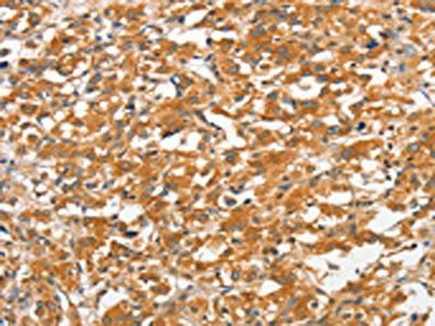 ANKMY2 Antibody