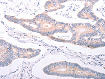 ANKRA2 Antibody