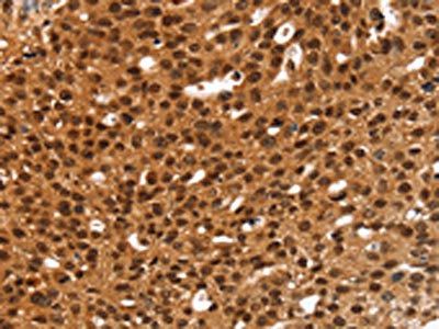 ANKRD1 Antibody