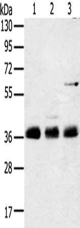 ANKRD1 antibody