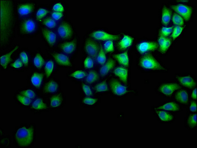 ANKRD2 Antibody