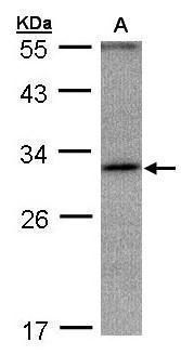 ankyrin repeat domain 45 Antibody