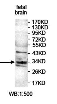 ANKRD45 antibody