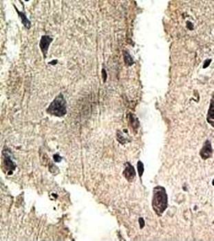 ANKRD50 Rabbit Polyclonal Antibody