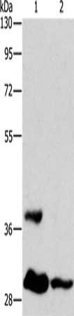ANKRD54 antibody