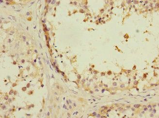 ANKS1B antibody