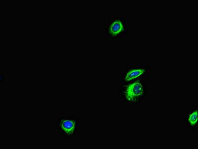 ANKS6 antibody