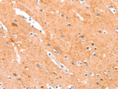 ANKZF1 Antibody