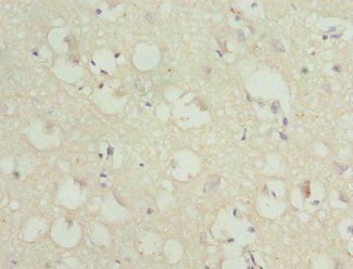ANLN Antibody