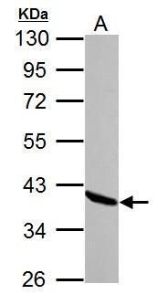 annexin A1 Antibody