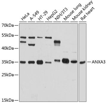 Annexin A3 antibody