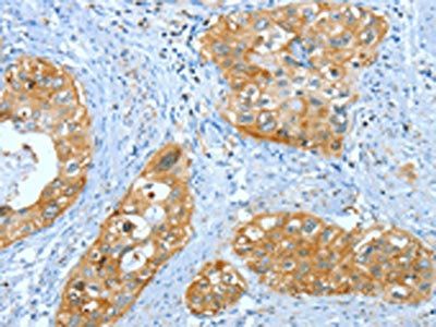 ANXA3 Antibody