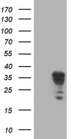 Annexin A3 Antibody