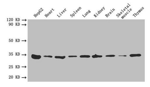 Annexin A5 antibody