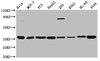 Annexin A5 antibody