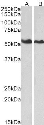 Annexin A11 antibody
