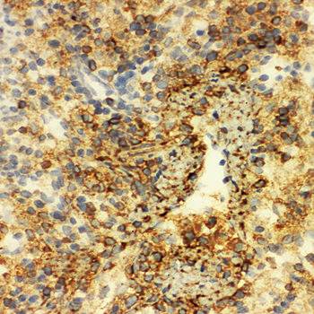 Anti-Annexin VI/ANXA6 Antibody