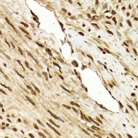 ANP32A antibody