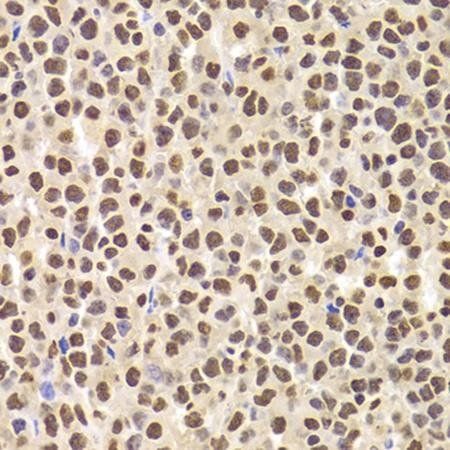 ANP32A antibody