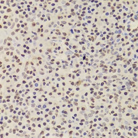 ANP32A antibody