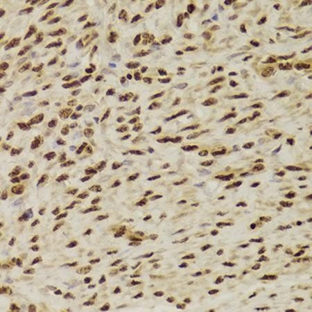 ANP32A antibody