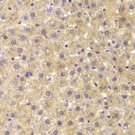 ANP32A antibody