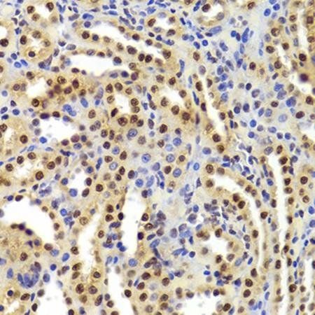 ANP32A antibody