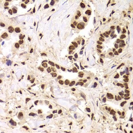 ANP32A antibody