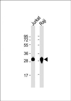 ANP32A antibody