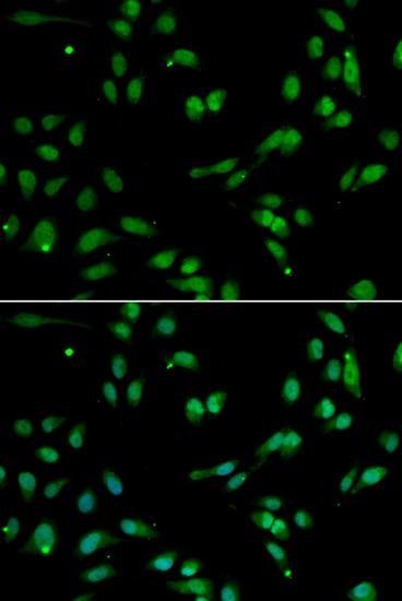 ANP32A antibody